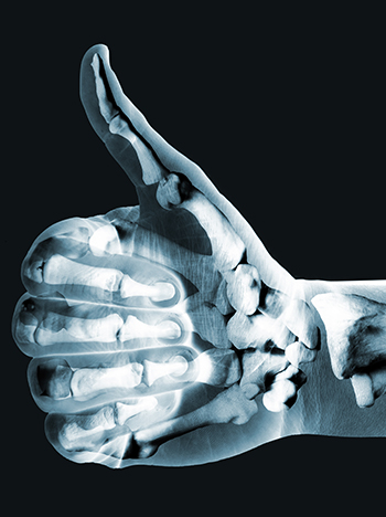 Le calcium et la vitamine D dans le jus d'orange de la Floride 1 x rayed hands
